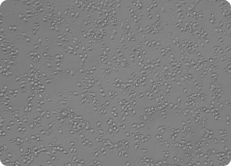 iPSC-derived neurons at Day 1 under microscopy.