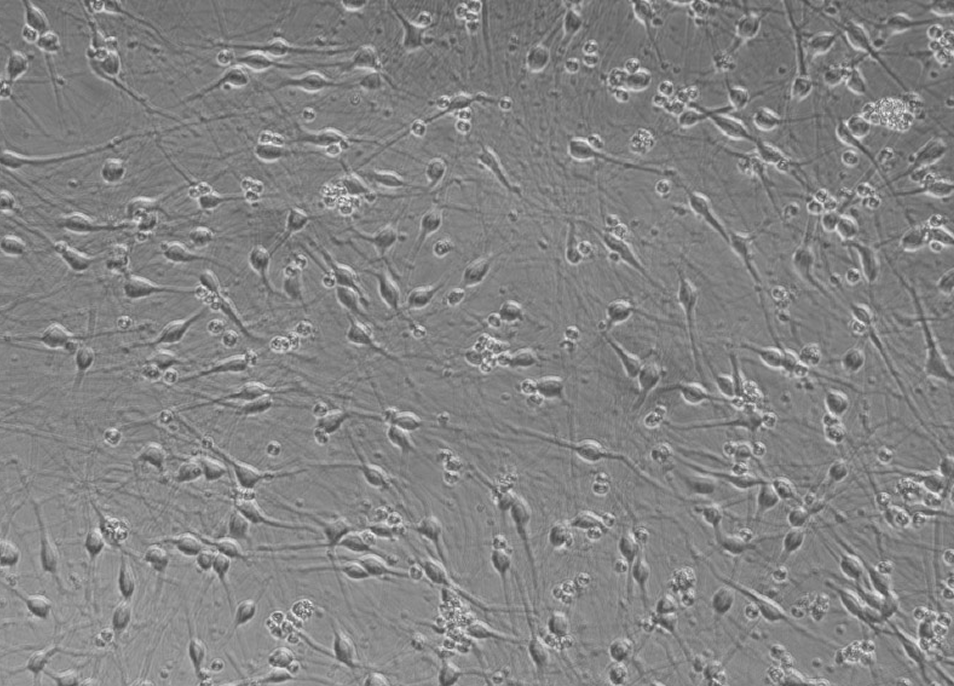 iPSC-derived neurons at Day 7 under microscopy.